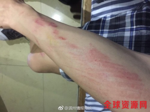 5月12日晚间，山东滨州学院一男生被其女朋友抱了一下被该校“自律委员会”成员发现，上前制止这种亲密行为过程中与该男生起争执并互殴。