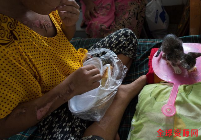 缅甸13岁女童工被熨斗烫 每周收入不到70元(组图)
