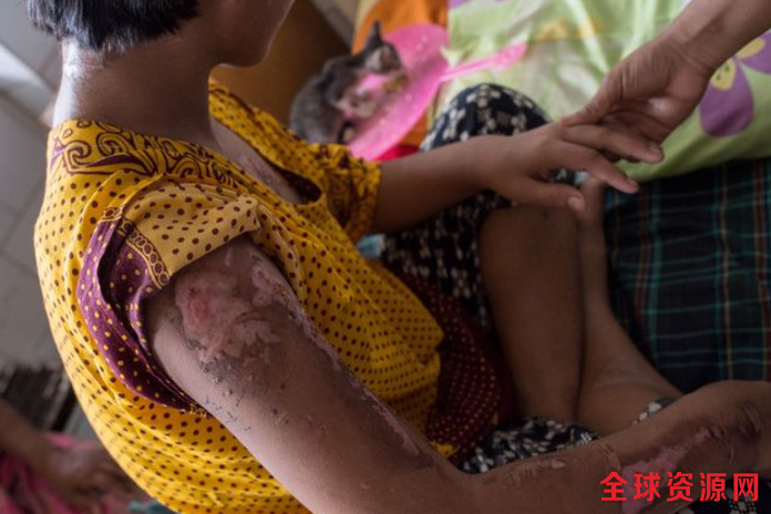 缅甸13岁女童工被熨斗烫 每周收入不到70元(组图)