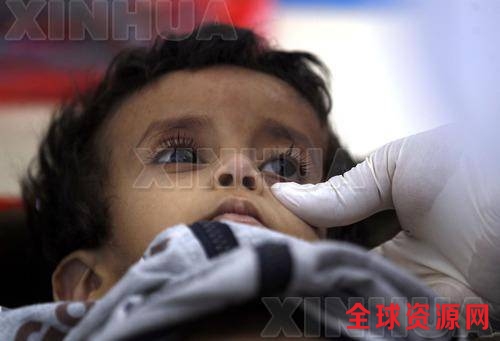 世界卫生组织6月8日发布声明说，也门疑似感染霍乱病例已超过10万人，789人因霍乱死亡。图为6月5日，在也门首都萨那，一名疑似感染儿童在一家临时医院内接受治疗。（新华社/法新）