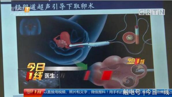 起底地下代孕黑链:14岁少女被骗卖卵 85万包成功