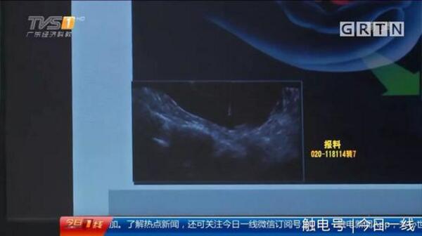 起底地下代孕黑链:14岁少女被骗卖卵 85万包成功