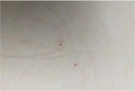 甘肃幼儿园被曝针扎幼儿 派出所疑让园方拿钱摆平