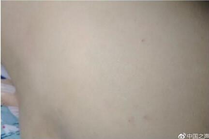 甘肃幼儿园被曝针扎幼儿 派出所疑让园方拿钱摆平