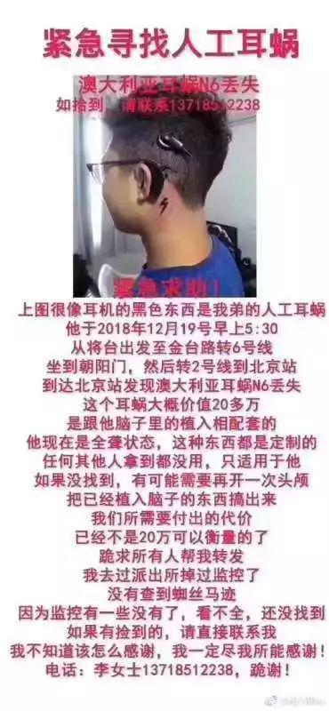 北京地铁丢耳蜗事件3大疑问:确有其事or商业炒作?