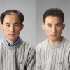 想买优惠的织发，就来兰州织发补发 西北哪里有专业织发的