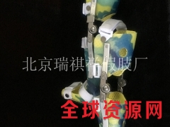 公司直营膝部矫形器_下肢矫形器_术后固定支具图2
