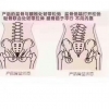 烟台徒手产后修复