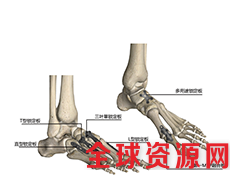 上海开为carefix2.5/2.7万向锁定板系统招商图1