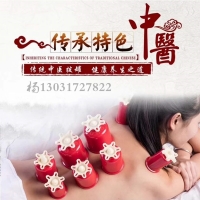 大红罐子拔罐器生产厂家 拔罐器怎么拿货