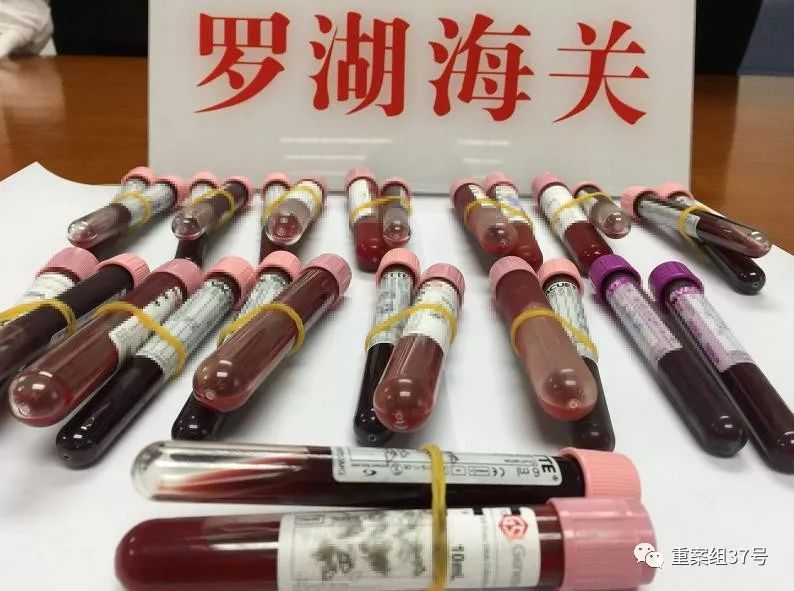  ▲深圳罗湖海关截获的部分人体血液样品。    罗湖海关 供图