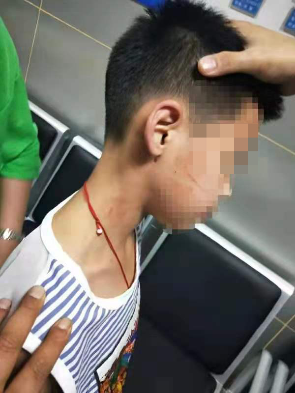 网传河北一体校教练体罚11岁男童 警方:属实正调查