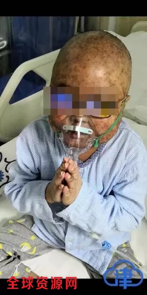 6岁白血病男童离世:花了400万 疑被医院当小白鼠