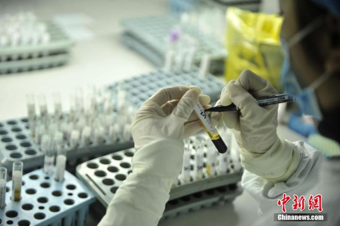 资料图:重庆新桥医院艾滋病筛查、确认实验室。图为医务人员标记样本。<a target='_blank' href='http://www.chinanews.com/'>中新社记者 陈超 摄 点击进入下一页