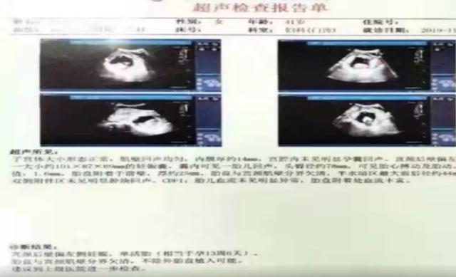 广西：女子已怀孕4个月，检查却发现子宫里是空的