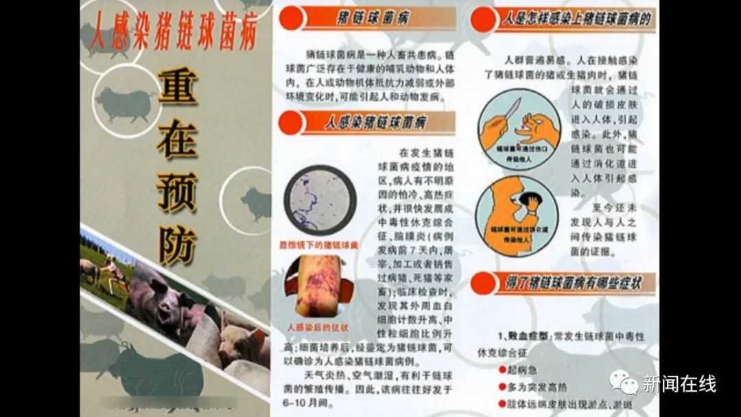 广西女子处理猪肉时被刺破手指，4天后患上罕见病，全球仅450例